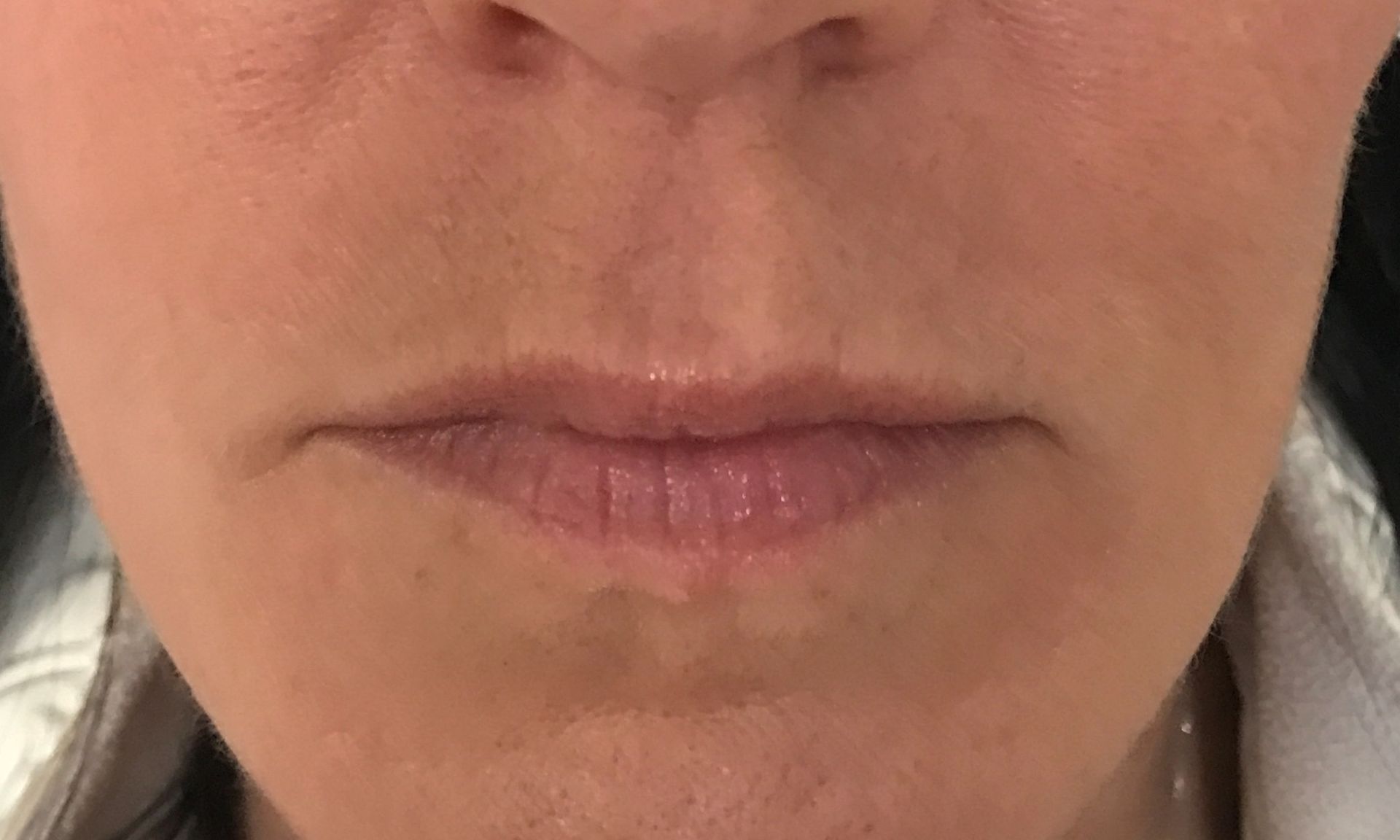 A close up of a woman 's mouth with wrinkles.